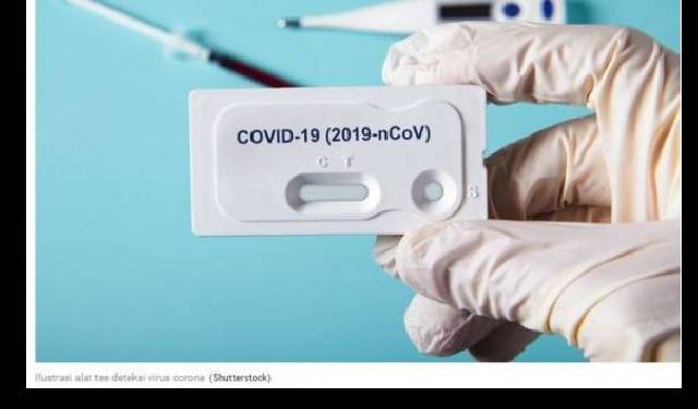 Lindungi Warga Dari Virus Corona, Pemkab Siap Gelar Rapid Test 